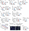 Loss of tumor cell–specific GLS increases T cell activation in an orthotopi