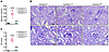 Podocyte overexpression of RARRESWT induces glomerular injury.