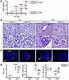 Podocyte Rarres1 knockdown attenuates albuminuria and glomerular injury in