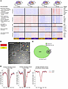 Transcriptional differences between MoAMs and TRAMs persist over the lifesp