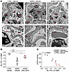 Histologic analysis of mouse kidney tissue demonstrates podocyte filter bar