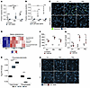 Metabolomics reveal altered lipid/PUFA profiles in CoQ-deficient Pdss2-depl