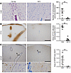 Depletion of PMNs prevents BBB disruption and astrocyte lesion formation 6