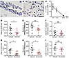 Inhibition of MMP-9 and elastase results in a significant reduction of astr