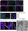 Resealing of the BBB to fibrinogen and tight junctions in human NMOSD lesio