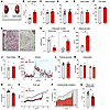 Adh1 deficiency drives pCF accumulation and impairments in cardiometabolic