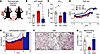 Retinaldehyde treatment rescues pCF remodeling and metabolic disorder in Ad