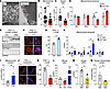 The ADH1/retinaldehyde pathway regulates pCF remodeling by altering mitocho