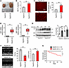 RagA/B cKO mice exhibit severe hypertrophy reminiscent of LSD.