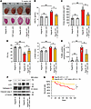 Heterozygous deletion of YAP in RagA/B cKO mice reduces cardiac hypertrophy