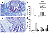 Immunohistochemical analysis of colon and prostate tumors. In separate expe