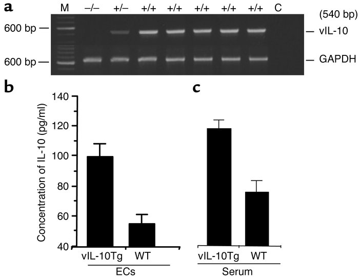 ECs from vIL-10Tg mice express mRNA for vIL-10 and secrete vIL-10 protei...