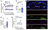 HAAO-derived QA mediates neuropathic pain through the upmodulation of NMDA