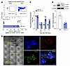 IDO1-expressing DCs accumulate in the DRL after SNI and contribute to the m