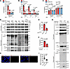 PLK1 inhibition reduces pro–caspase 1 and pro–IL-1β cleavage and ASC speck