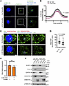 PLK1 regulates microtubule nucleation and affects NLRP3 inflammasome positi