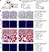 PLK1 inhibition suppresses the inflammatory response in a LPS-induced endot