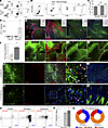 CD8+ neuronal antigen–specific T (nasT) cells are recruited to the demyelin