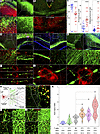 CD8+ nasT cells injure neurons in the demyelinated brain.