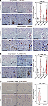 Neuronal MHC class I and β2M expression is upregulated in MS patient brain