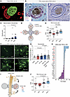 Mutant TPAC mice represent a model for human-like PNI.