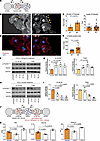 The migration behavior of cancer cells triggered by neurons is regulated by