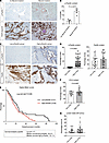 Paxillin phosphorylation in cancer cells is associated with poorer survival