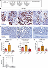 CCL2/CCR4 axis regulates paxillin phosphorylation and innervation in KPC mi