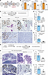 Inhibition of Paxillin-Src-Erk signalosome in vitro and in vivo.