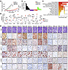 Bi-steric compounds showed greater tumor suppression in vivo than rapamycin