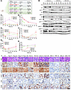 Single-dose assessment of bi-steric inhibitors in the Tsc2+/– A/J mouse kid