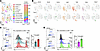 scRNA-Seq analysis reveals alterations in immune landscape of TREM1-deficie