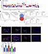 TREM1 expression is associated with poor prognosis in selected human tumors