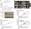 BACH1 increases tumor vascularity and the response to anti-VEGF therapy in