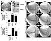 Del-1 induces angiogenesis in rabbit model of ischemia. (a) Angiography was