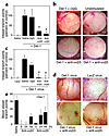 Del-1–mediated angiogenesis requires integrins αvβ3 and αvβ5. (a and b) Del