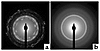 X-ray diffraction patterns of crystalline deposits in CaOx and intestinal-b