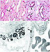 Initial sites of crystal deposition. This set of illustrations shows the in