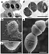 Visualization of streptococcal capsule and binding of CIV gold complexes to