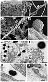 S. pyogenes colonizes collagen in vitro and in vivo. FESEM analysis shows S