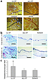 LL-37 induces physiologic angiogenesis in the CAM assay. (a) LL-37 (5 μg/pe