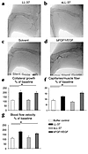 LL-37 induces angiogenesis and arteriogenesis in the rabbit hind-limb model