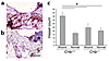 Mice with disrupted Cnlp gene show decreased wound revascularization. (a an