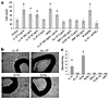 Effects of LL-37 on endothelial cells in vitro. (a) In vitro proliferation