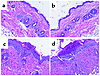 Representative histology. Representative skin histology from BALB/c recipie