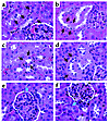 Histological examination of the kidneys of aP2-HSD1 mice and non-Tg litterm