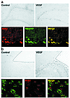 Colocalization of BrdU and markers of neuronal lineage in DG (a) and SVZ (b