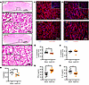 Third trimester–equivalent maSCV2 infection disrupts the trophoblast layer