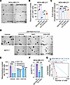 ZMYND8 promotes maintenance of ALDHhi BCSCs through reducing ROS.