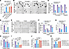 ZMYND8 inhibits ferroptosis in ALDHhi BCSCs.